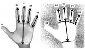 Caption These are images of male and female hand with measurements that determine gender. Credit Dean Snow